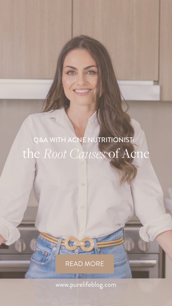 Q&A with Acne Nutritionist: the Root Causes of Acne